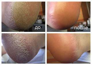 604 X 427 152.9 Kb !  + - 550 .