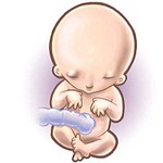 click for enlarge 400 X 400 30,2 Kb picture