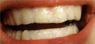 click for enlarge 640 X 298 27.3 Kb picture