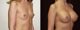 click for enlarge 600 X 226 27.9 Kb picture