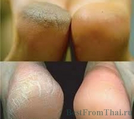 click for enlarge 400 X 357 66.1 Kb picture