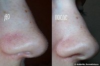 click for enlarge 320 X 213 11.3 Kb picture