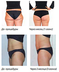 click for enlarge 266 X 324 77.7 Kb picture