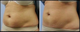 click for enlarge 563 X 227 36.2 Kb picture