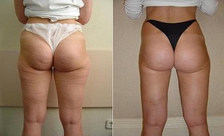 click for enlarge 510 X 311 34.6 Kb picture