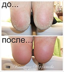 1920 X 2156 375.7 Kb ! !