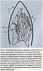 369 X 604 98.7 Kb 412 X 309 12.9 Kb НОВИНКА! Кислотно-ферментативный педикюр (Израиль)