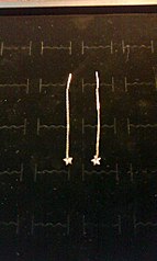 614 X 1024 97.4 Kb 614 X 1024 141.3 Kb , , .