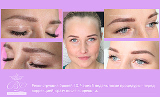 1920 X 1167 490.4 Kb 1920 X 1167 410.8 Kb New!6 д реконструкция бровей, наращивание ресничек