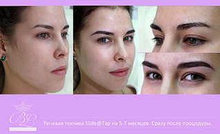 1920 X 1167 519.6 Kb New!6 д реконструкция бровей, наращивание ресничек
