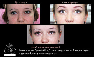 1920 X 1167 425.6 Kb 1920 X 1167 503.3 Kb New!6 д реконструкция бровей, наращивание ресничек