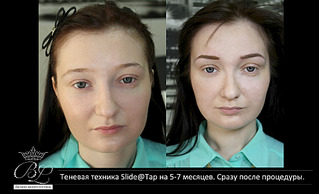 1920 X 1167 373.6 Kb 1920 X 1167 425.6 Kb 1920 X 1167 503.3 Kb New!6 д реконструкция бровей, наращивание ресничек