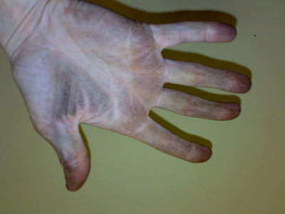 2048 X 1536 351.8 Kb Кот Мишенька. Оперировать нельзя ампутировать.